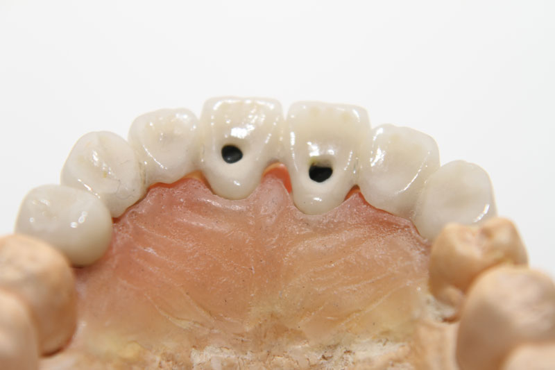 Ankara Diş Protez Laboratuvarları